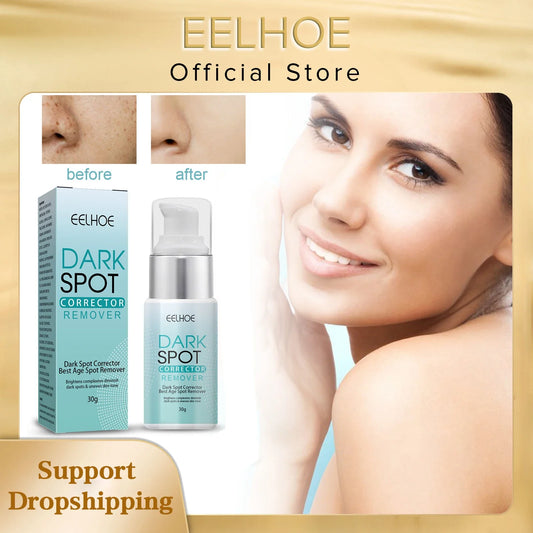 EELHOE lightening Freckle Cream Nicotinamide Dark Spot Remover Skin Care Moisturizing Brighten Anti-aging Fade Spot Face Beauty