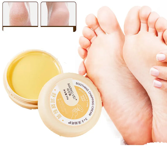 Anti Drying Cracking Foot Cream Heel Cracked Repair Cream Moisturizing Removal Dead Skin Hand Chapping Cream Feet Skin Care 20g