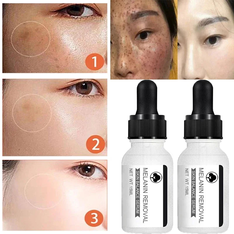 Niacinamide Serum Remove Dark Spots Whitening Moisture Powerful Removal Melasma Chloasma Black Freckle Face Skin Care Cream