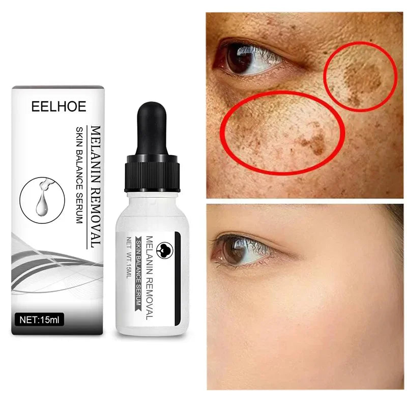 Niacinamide Serum Remove Dark Spots Whitening Moisture Powerful Removal Melasma Chloasma Black Freckle Face Skin Care Cream