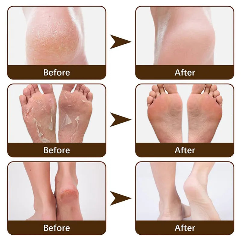 Anti Drying Cracking Foot Cream Heel Cracked Repair Cream Moisturizing Removal Dead Skin Hand Chapping Cream Feet Skin Care 20g